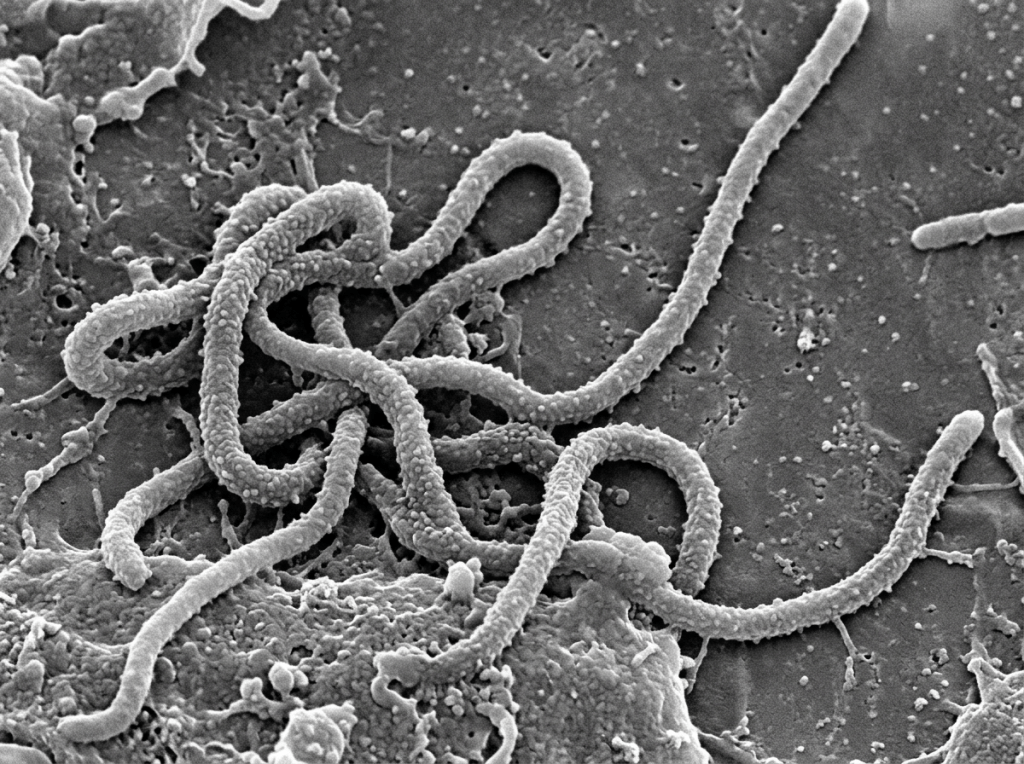 Coiled Ebola virus particles under electron microscope.